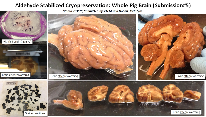 Slides showing an ASC-preserved pig brain.